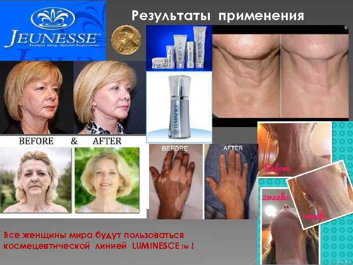 Результаты применения Все женщины мира будут пользоваться космецевтической линией LUMINESCE TM ! 