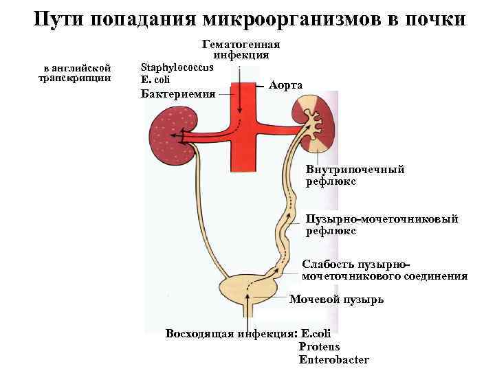 Пути попадания микроорганизмов в почки Гематогенная инфекция в английской транскрипции Staphylococcus E. coli Бактериемия