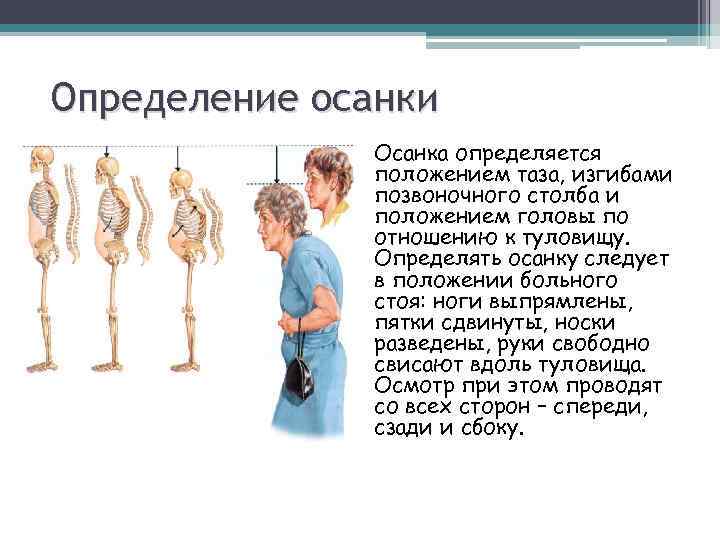 Определение осанки Осанка определяется положением таза, изгибами позвоночного столба и положением головы по отношению