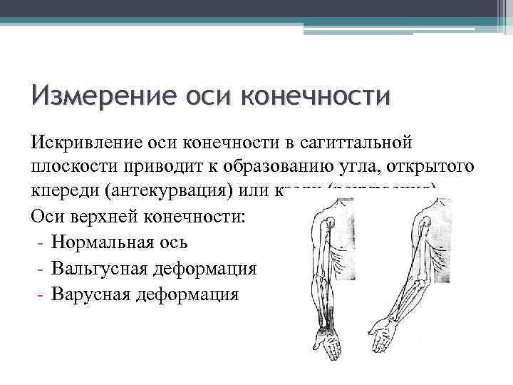 Измерение оси конечности Искривление оси конечности в сагиттальной плоскости приводит к образованию угла, открытого