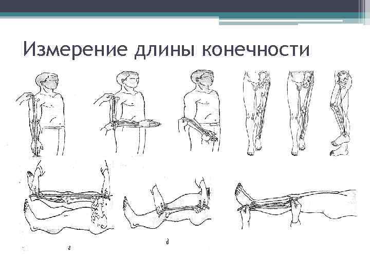 Измерение длины конечности 