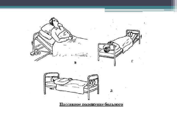 Пассивное положение больного 