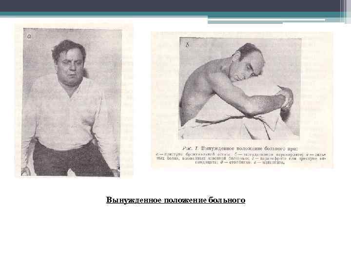 Вынужденное положение больного 