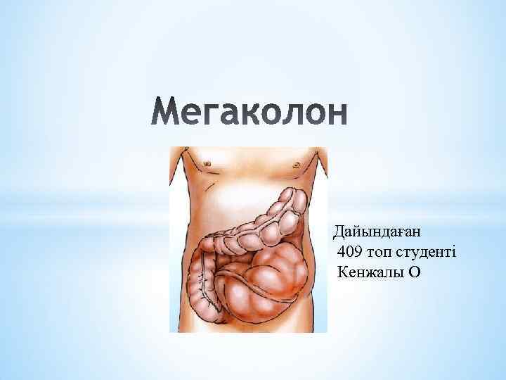 Дайындаған 409 топ студенті Кенжалы О 