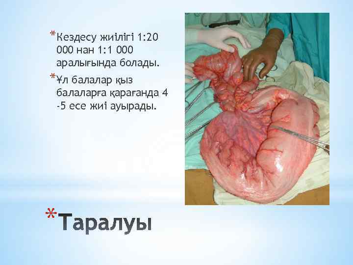 *Кездесу жиілігі 1: 20 000 нан 1: 1 000 аралығында болады. *Ұл балалар қыз