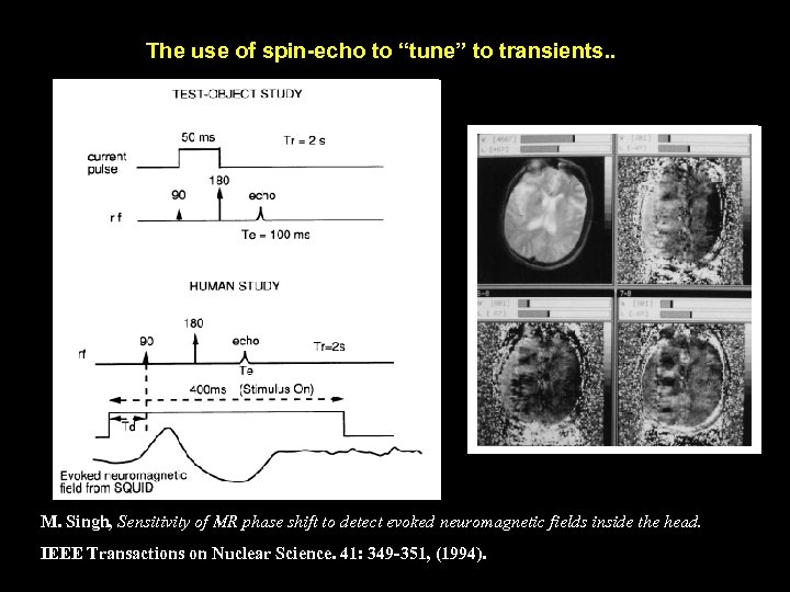 The use of spin-echo to “tune” to transients. . M. Singh, Sensitivity of MR
