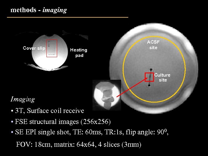methods - imaging Cover slip Heating pad ACSF site Culture site Imaging • 3