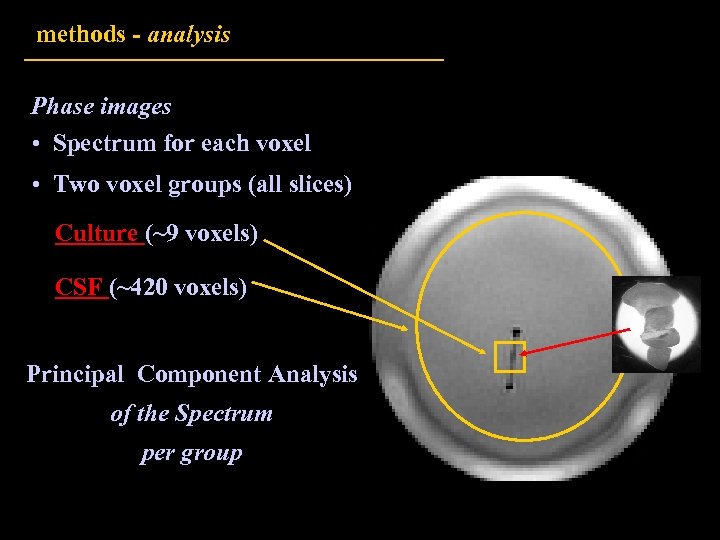 methods - analysis Phase images • Spectrum for each voxel • Two voxel groups