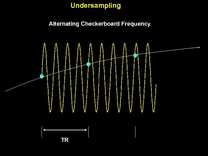 Undersampling Alternating Checkerboard Frequency TR 