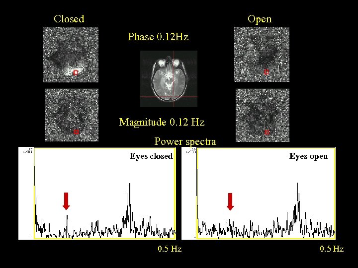 Closed Open Phase 0. 12 Hz Magnitude 0. 12 Hz Power spectra Eyes closed