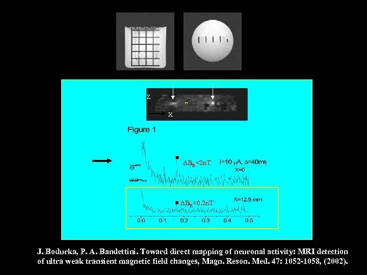 Z X BR<2 n. T BR<0. 2 n. T J. Bodurka, P. A. Bandettini.