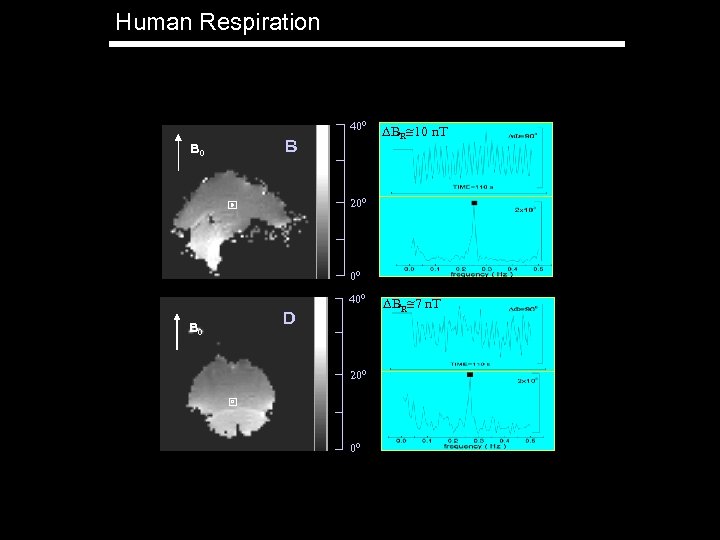 Human Respiration 400 B BR 10 n. T 200 00 400 B 0 D