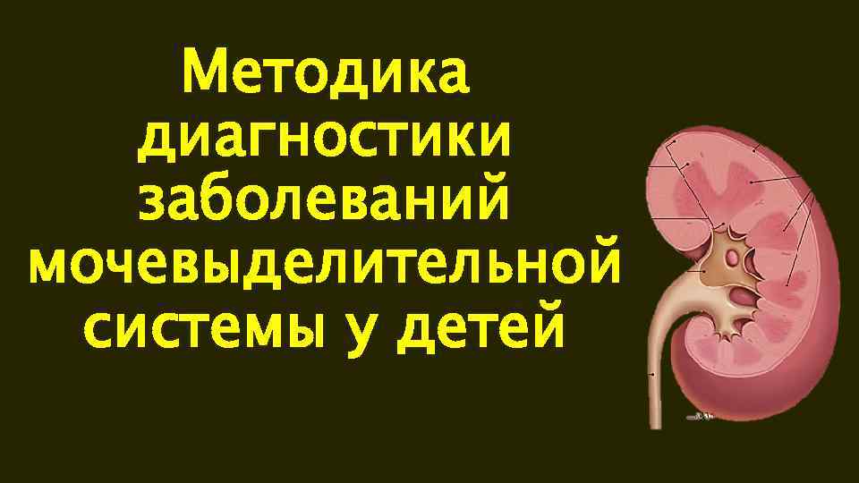 Афо мочевыделительной системы у детей презентация