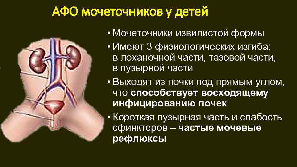 АФО мочеточников у детей • Мочеточники извилистой формы • Имеют 3 физиологических изгиба: в
