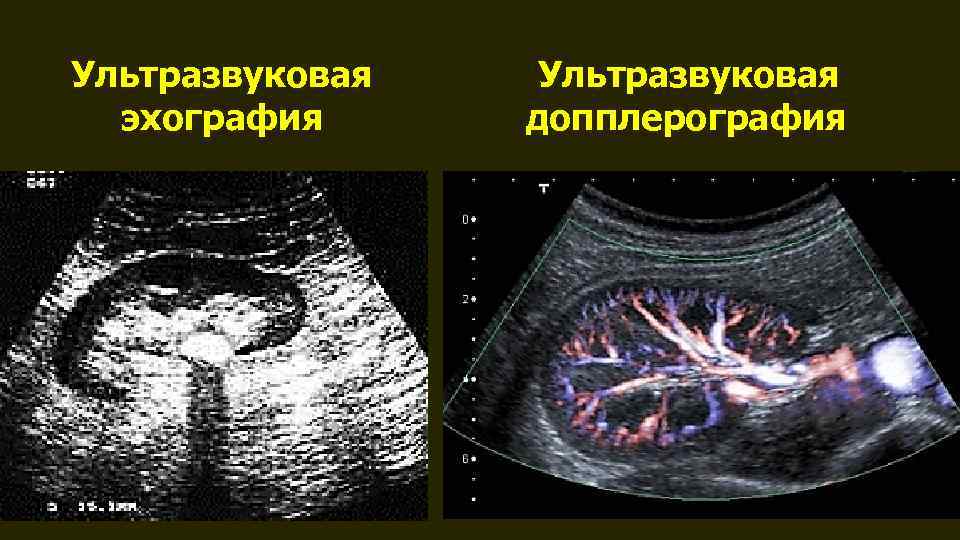 Ультразвуковая эхография Ультразвуковая допплерография 