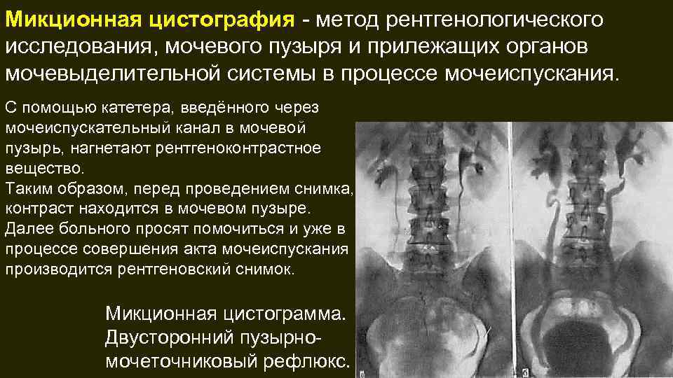 Методы рентгенологического исследования презентация