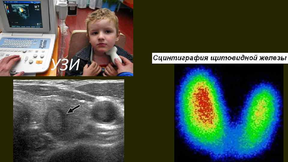 УЗИ 