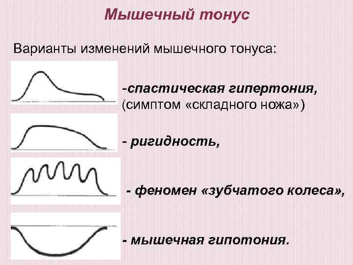 Варианты изменения. Тонус мышц по типу складного ножа. Варианты изменения мышечного тонуса:. Гипертонус мышц по типу складного ножа. Симптом складного ножа неврология.