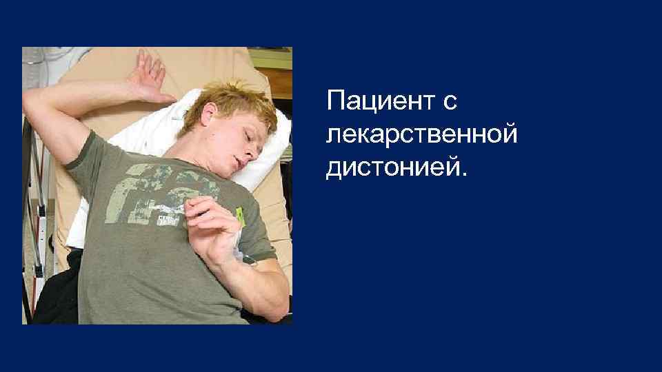 Пациент с лекарственной дистонией. 