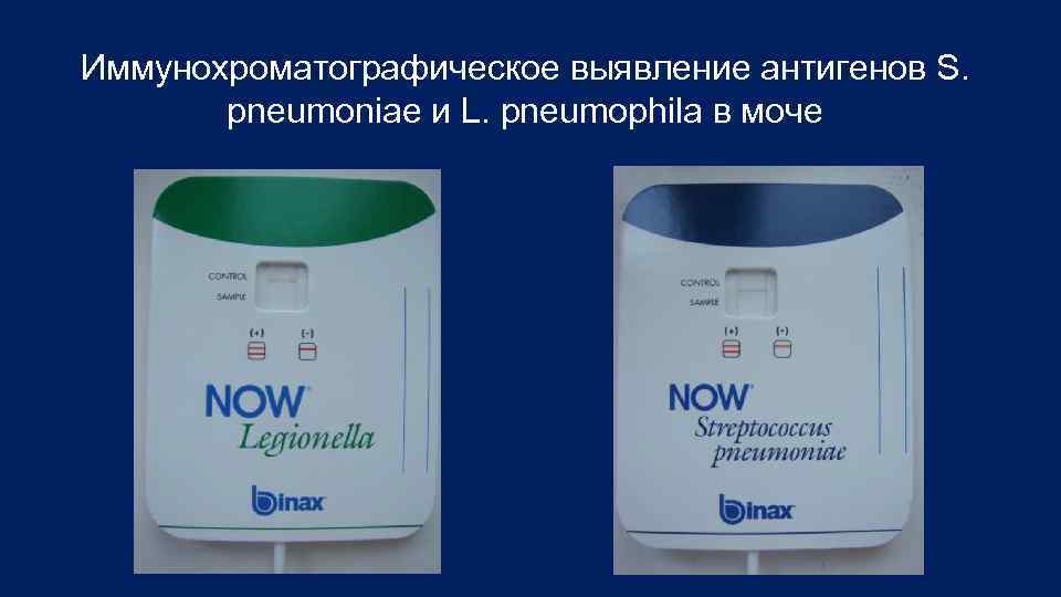 Иммунохроматографическое выявление антигенов S. pneumoniae и L. pneumophila в моче 