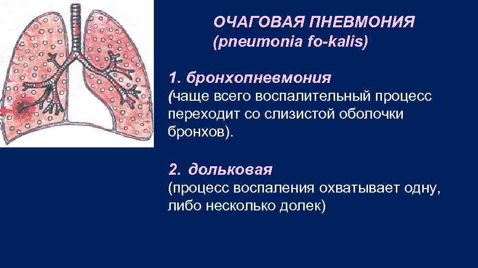ОЧАГОВАЯ ПНЕВМОНИЯ (pneumonia fo kalis) 1. бронхопневмония (чаще всего воспалительный процесс переходит со слизистой