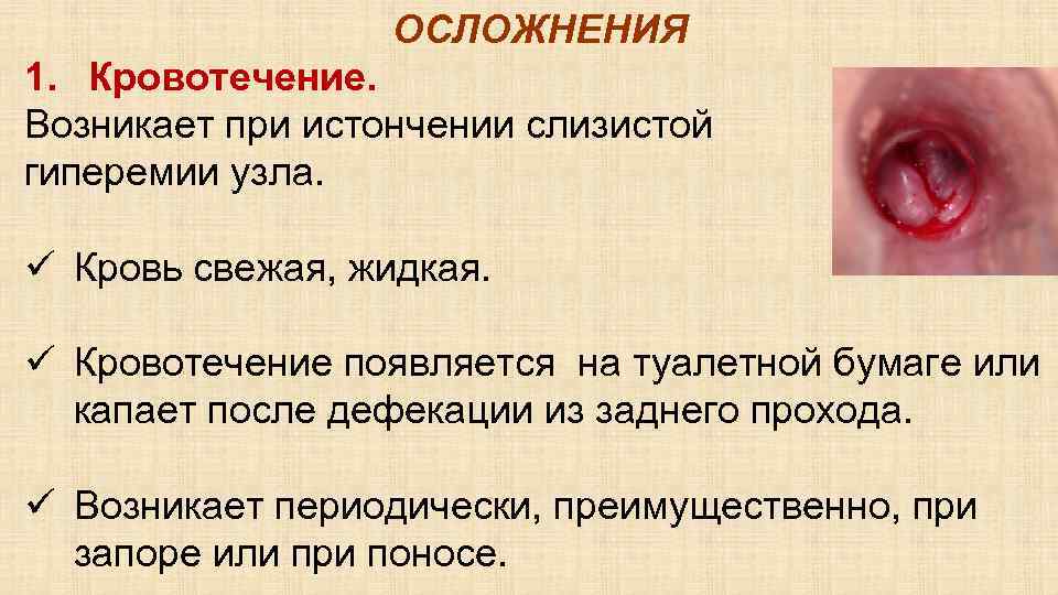 ОСЛОЖНЕНИЯ 1. Кровотечение. Возникает при истончении слизистой и гиперемии узла. ü Кровь свежая, жидкая.