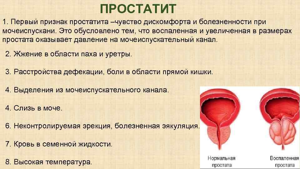 Признаки простаты. Первые признаки простаты. Симптомы простатита у женщин симптомы. Первые проявления простатита.