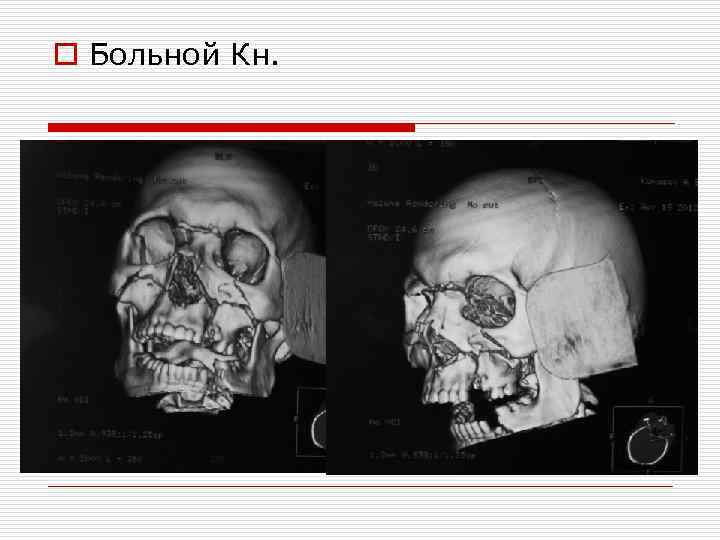 o Больной Кн. 