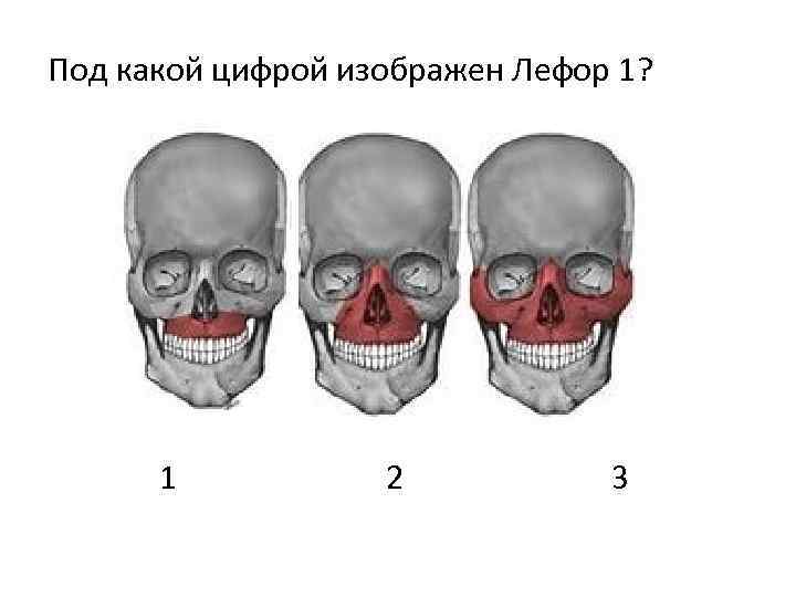 Под какой цифрой изображен Лефор 1? 1 2 3 