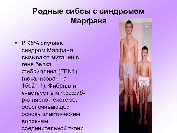 Родные сибсы с синдромом Марфана • В 95% случаев синдром Марфана вызывают мутации в