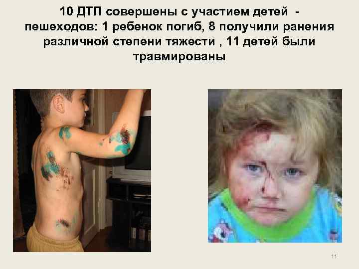 10 ДТП совершены с участием детей пешеходов: 1 ребенок погиб, 8 получили ранения различной