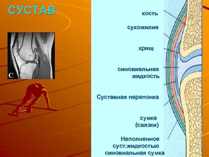 СУСТАВ кость сухожилие хрящ синовиальная жидкость Суставная перепонка сумка (связки) Наполненное суст. жидкостью синовиальная