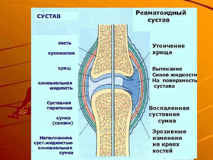 Суставная жидкость