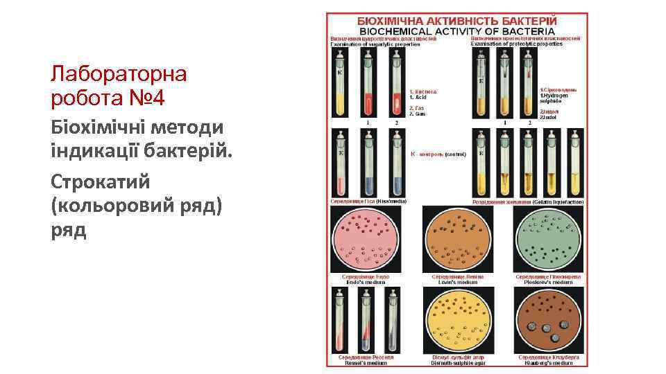 Лабораторна робота № 4 Біохімічні методи індикації бактерій. Строкатий (кольоровий ряд) ряд 