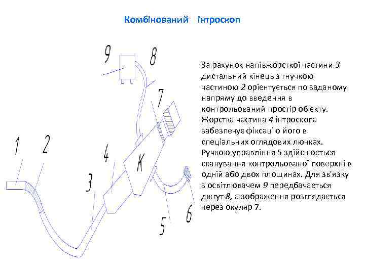 Комбінований інтроскоп За рахунок напівжорсткої частини 3 дистальний кінець з гнучкою частиною 2 орієнтується