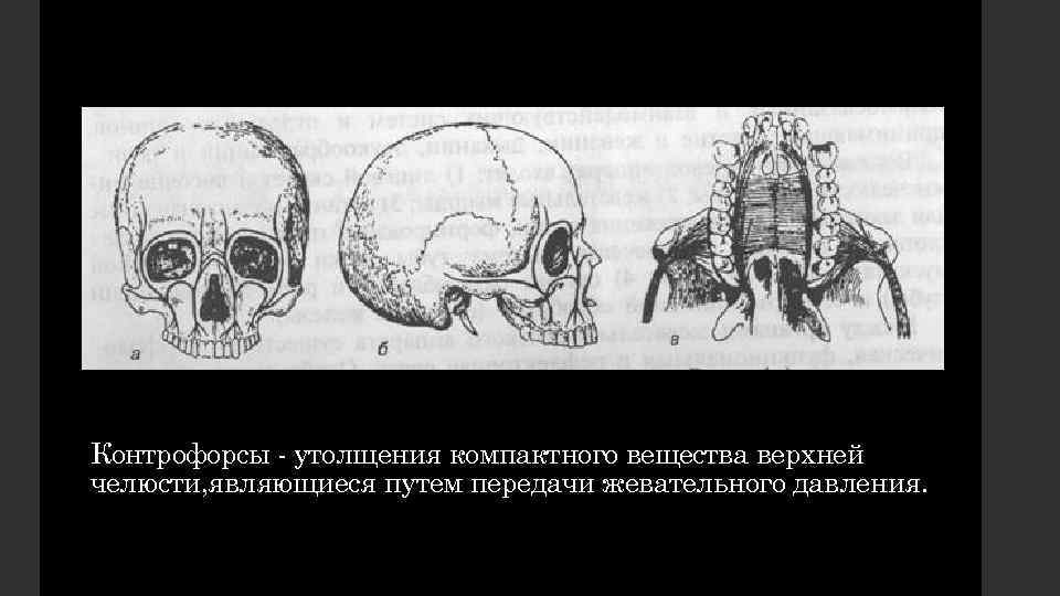 Контрофорсы - утолщения компактного вещества верхней челюсти, являющиеся путем передачи жевательного давления. 