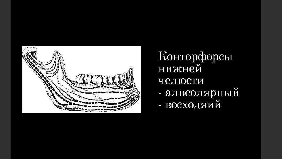 Конторфорсы нижней челюсти - алвеолярный - восходяий 