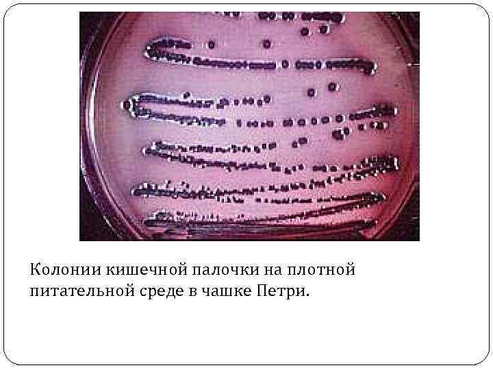 Колонии кишечной палочки на плотной питательной среде в чашке Петри. 