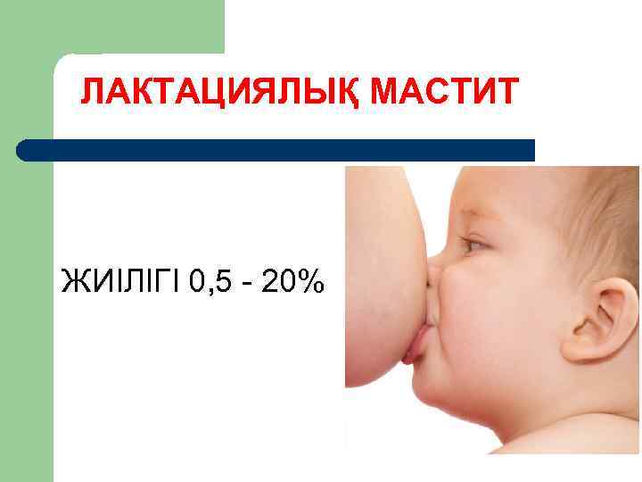 ЛАКТАЦИЯЛЫҚ МАСТИТ ЖИІЛІГІ 0, 5 20% 