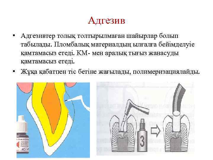 Адгезив • Адгезивтер толық толтырылмаған шайырлар болып табылады. Пломбалық материалдың ылғалға бейімделуіе қамтамасыз етеді.