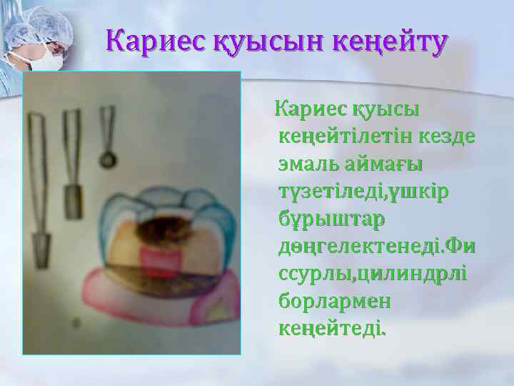 Кариес қуысын кеңейту Кариес қуысы кеңейтілетін кезде эмаль аймағы түзетіледі, үшкір бұрыштар дөңгелектенеді. Фи