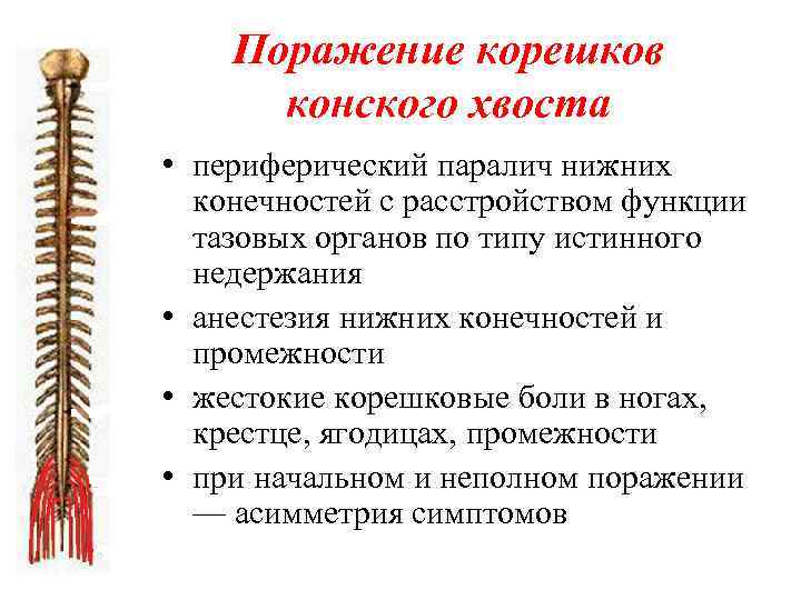 Поражение корешков конского хвоста • периферический паралич нижних конечностей с расстройством функции тазовых органов