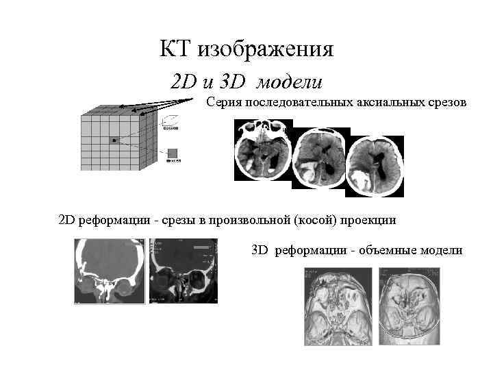 КТ изображения 2 D и 3 D модели Серия последовательных аксиальных срезов 2 D