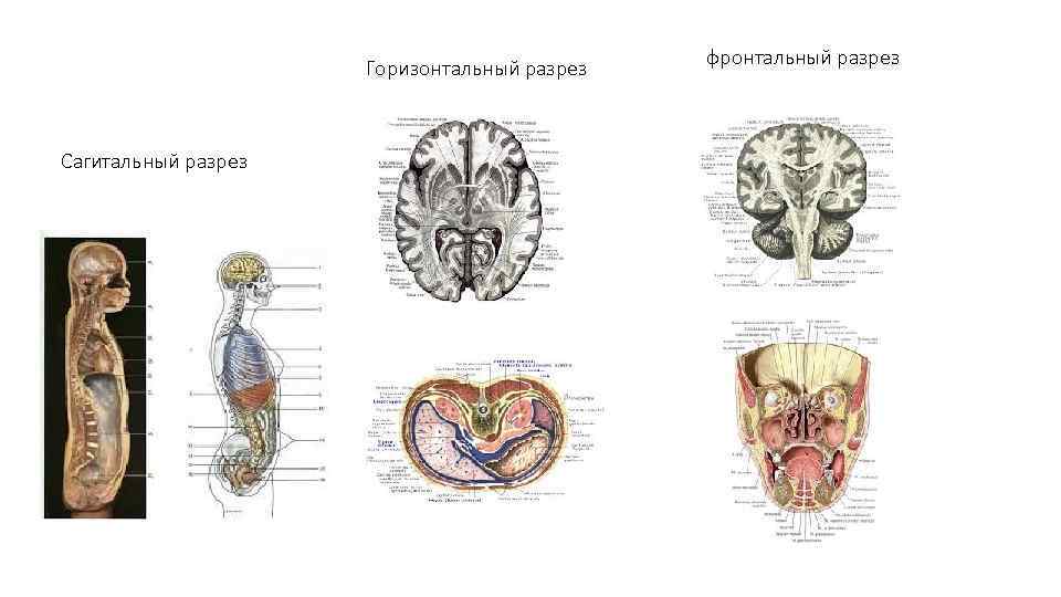 Горизонтальный разрез Сагитальный разрез фронтальный разрез 