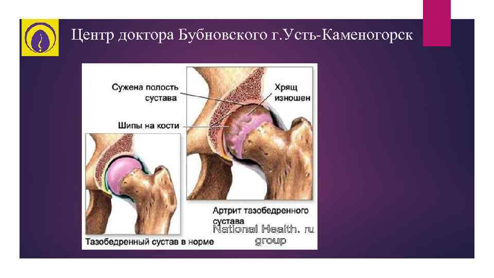 Центр доктора Бубновского г. Усть-Каменогорск 