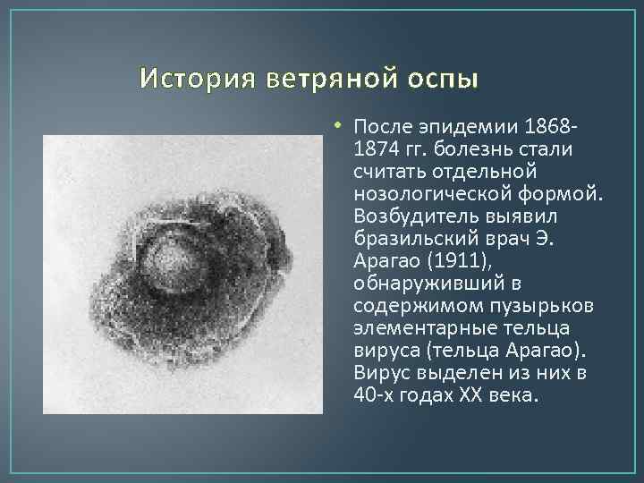 История ветряной оспы • После эпидемии 18681874 гг. болезнь стали считать отдельной нозологической формой.