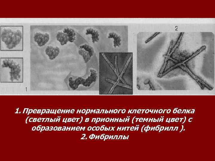 1. Превращение нормального клеточного белка (светлый цвет) в прионный (темный цвет) с образованием особых