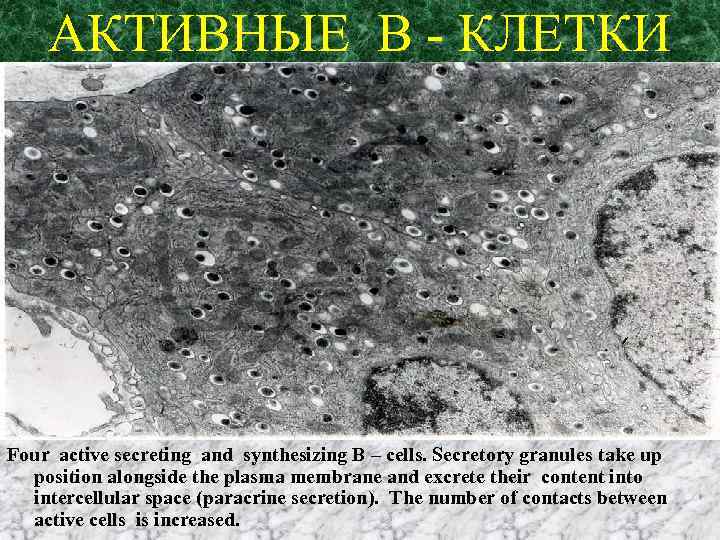 АКТИВНЫЕ В - КЛЕТКИ Four active secreting and synthesizing B – cells. Secretory granules