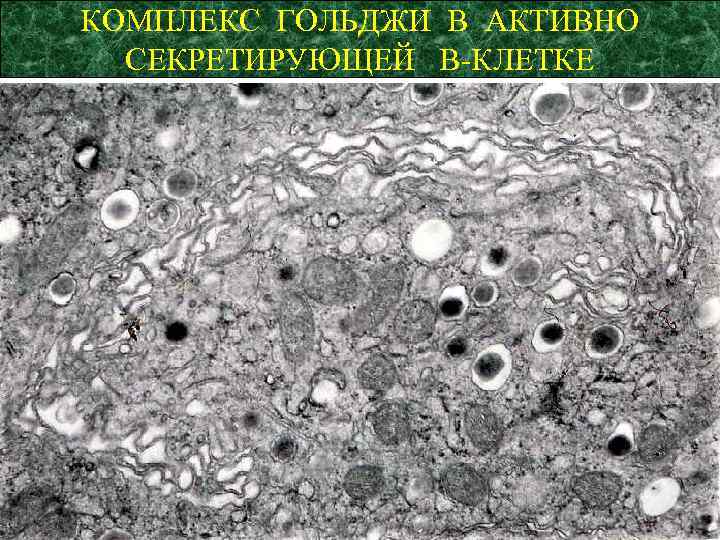 КОМПЛЕКС ГОЛЬДЖИ В АКТИВНО СЕКРЕТИРУЮЩЕЙ В-КЛЕТКЕ 