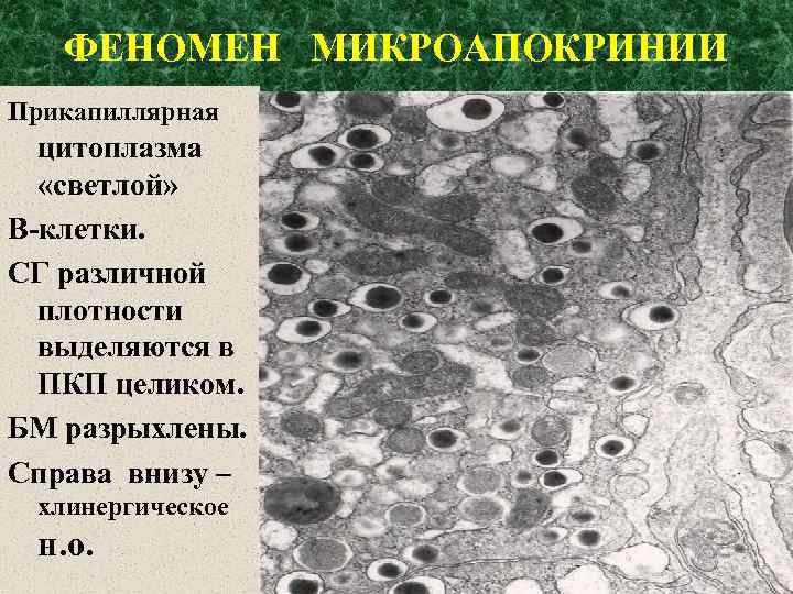 ФЕНОМЕН МИКРОАПОКРИНИИ Прикапиллярная цитоплазма «светлой» В-клетки. СГ различной плотности выделяются в ПКП целиком. БМ